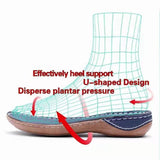 Vipkoala Summer Women Sandals Wedges Orthopedic Hollow Out Ladsies Casuasl Shoes Slip on Vintage Female Sandals Chaussure Femme sandals